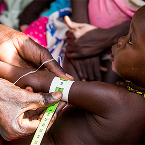 A health worker measures a baby’s arm during the launch of the joint nutrition response plan in Aweil, South Sudan.