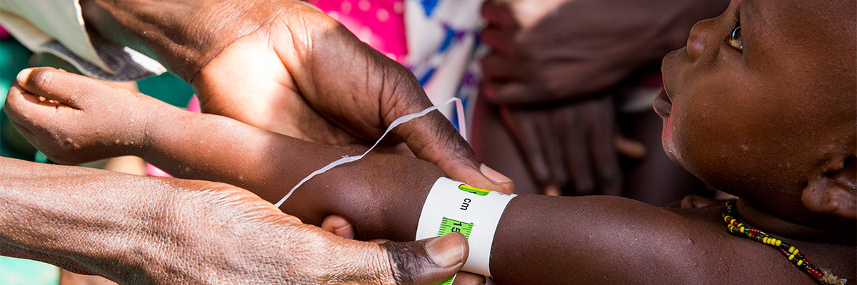 A health worker measures a baby’s arm during the launch of the joint nutrition response plan in Aweil, South Sudan.