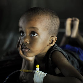 索马里摩加迪沙医疗诊所里的一名年幼的疟疾患者恢复健康，摄于2013年。联合国图片/Tobin Jones