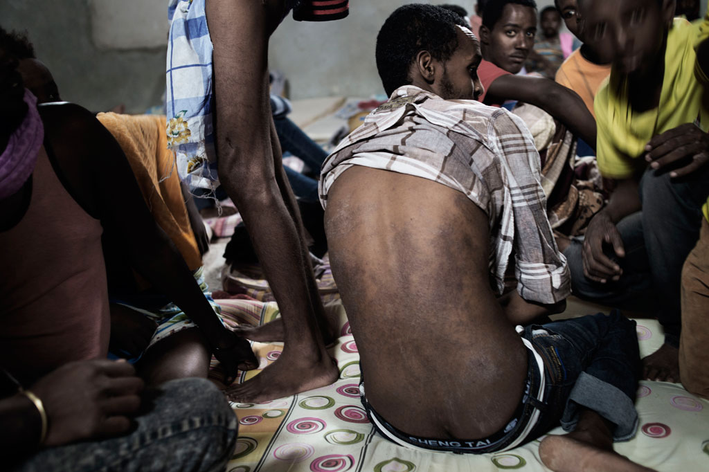 Un Erythréen montre son dos avec une maladie de peau contractée dans une cellule dans un centre de détention près de Tripoli, en Libye. Photo UNICEF/Alessio Romenzi