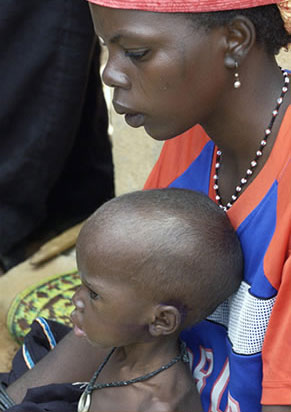 Nigerian woman and a malnurished child