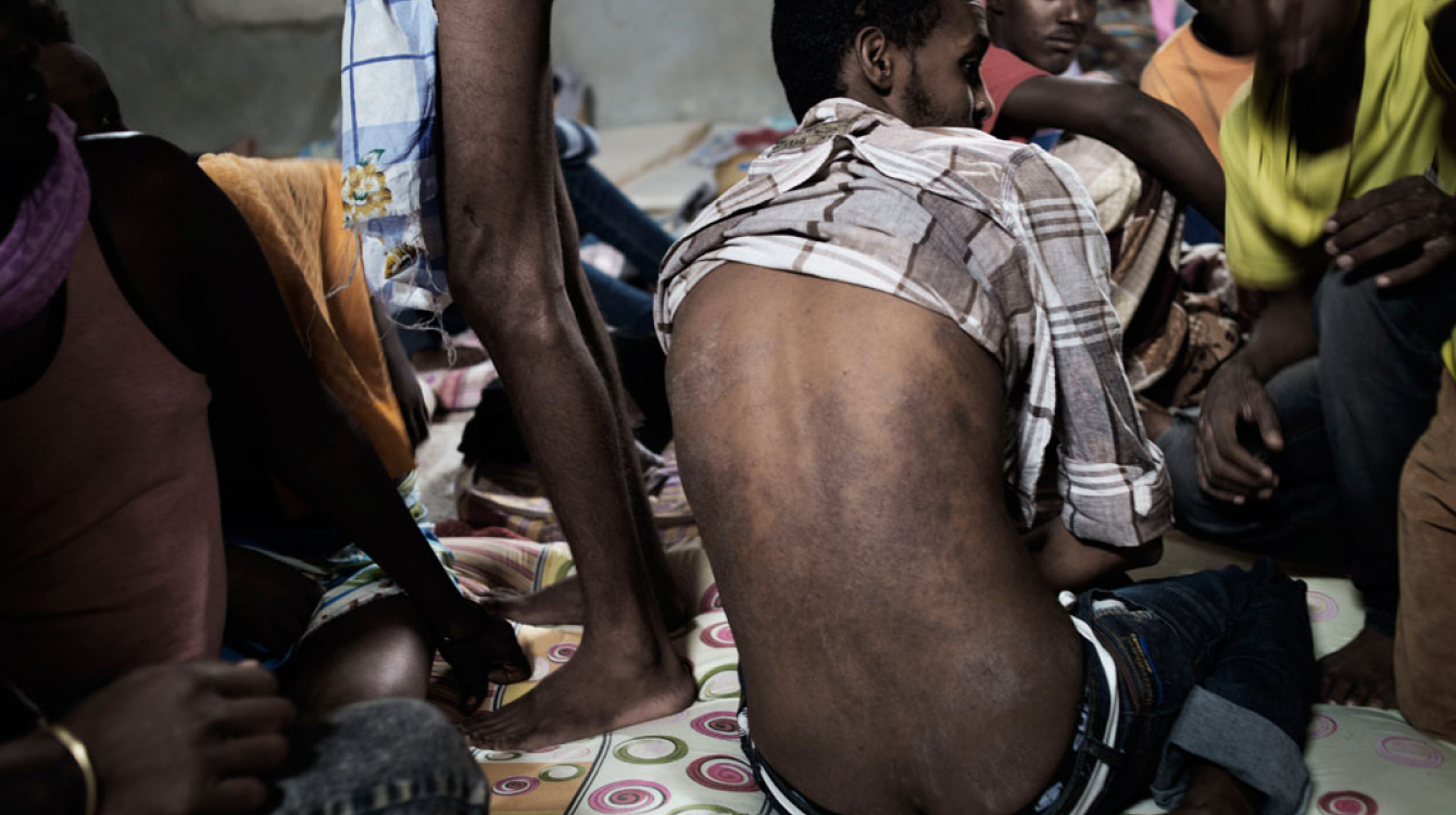 Un Erythréen montre son dos avec une maladie de peau contractée dans une cellule dans un centre de détention près de Tripoli, en Libye. Photo UNICEF/Alessio Romenzi