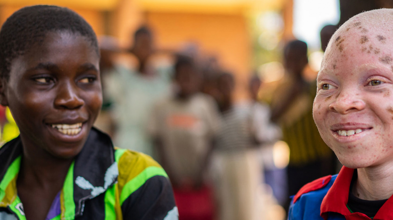 Chinsisi Jafali, a 14-year-old with albinism in Malawi