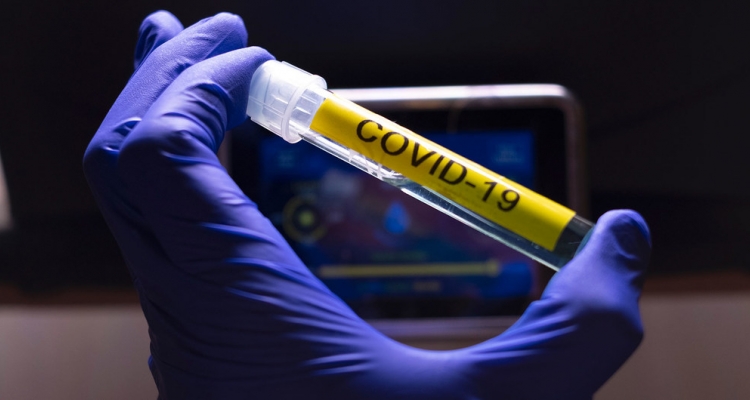 Utafiti unaendelea katika kusaka chanjo na tiba ya virusi vya Corona, COVID-19