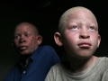 A child living with albinism and his father in Dar es Salaam, Tanzania. Photo: Panos/ Dieter Telemans