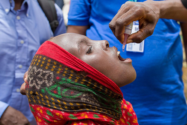 A girl opens her mouth and looks up to receive an oral vaccine. 