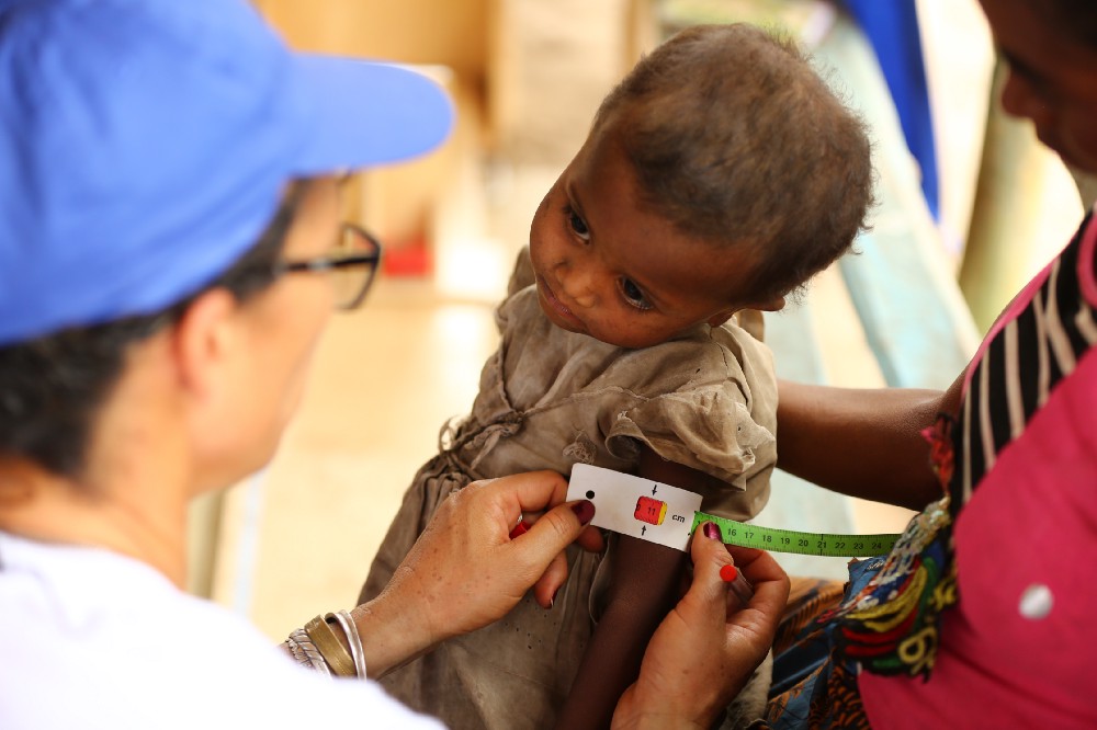 A measuring tape is used to measure the circumference of a child's arm.