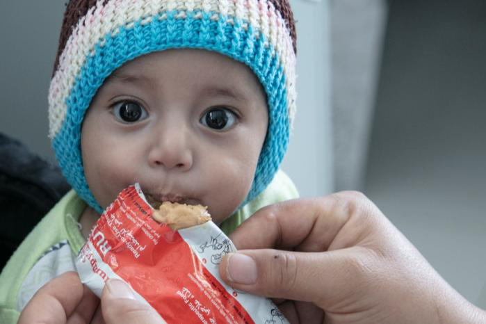 Yemen. A small child is fed a nutrition bar.