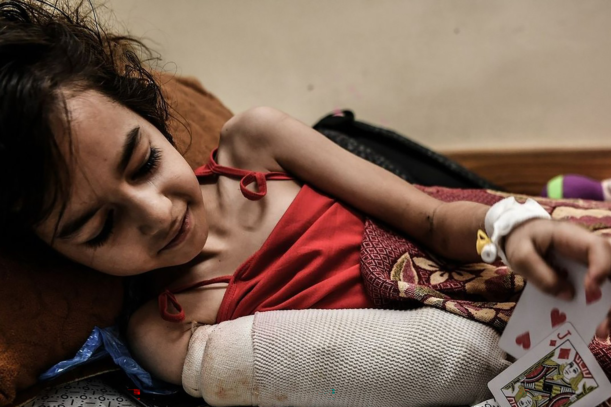 A seriously injured Palestinian girl playing cards.