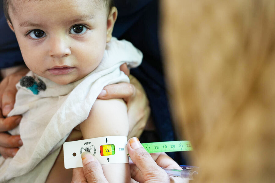 Un enfant regarde la caméra pendant qu'un médecin lui mesure la circonférence de son bras