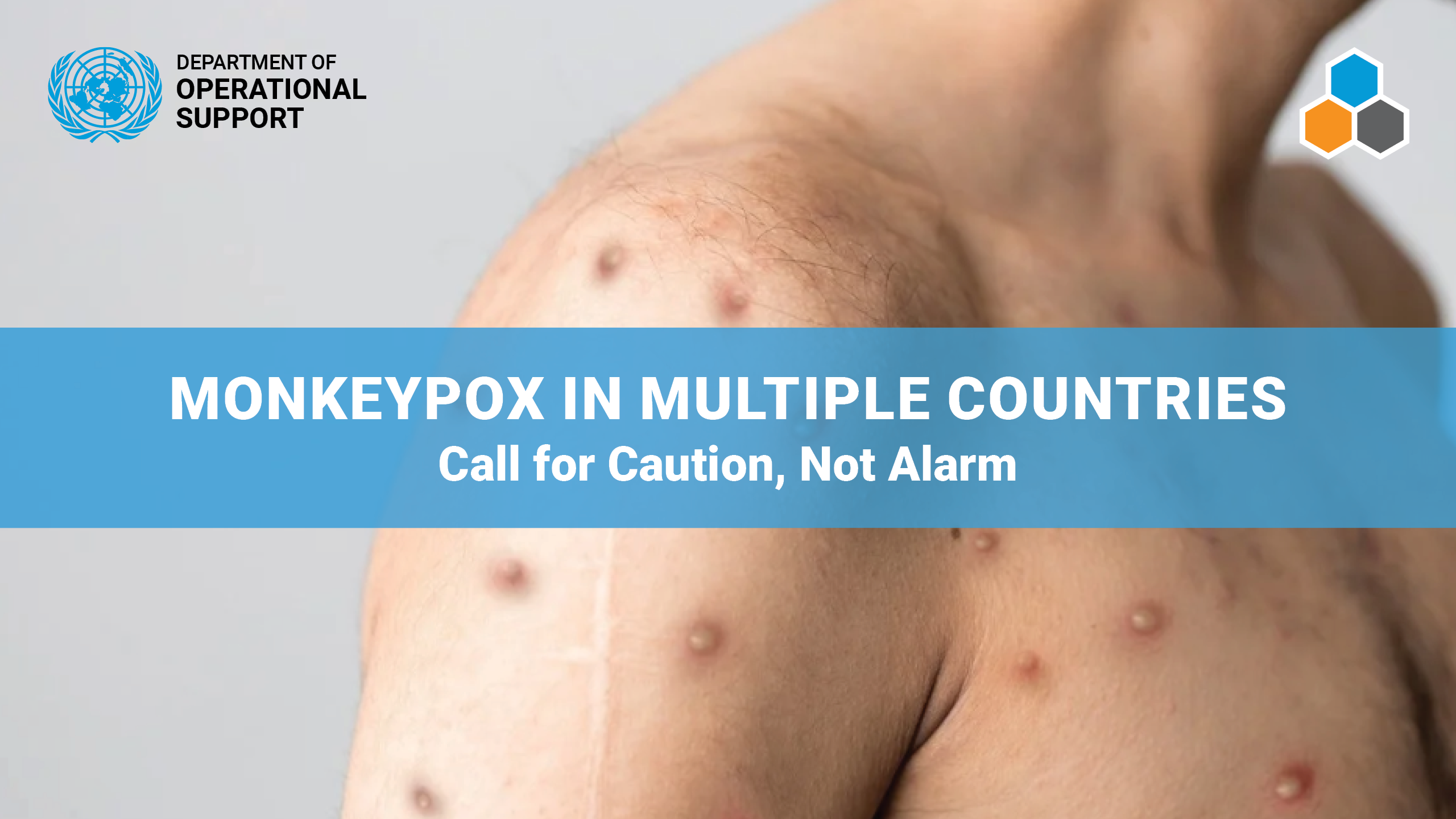 Monkeypox in multiple countries– call for caution, not alarm