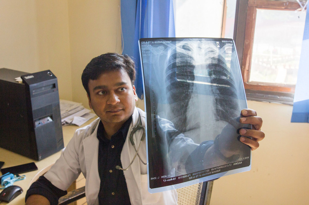 A doctor checks a patient’s x-ray for lung damage, which may indicate tuberculosis.
