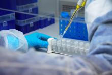 Feevale University performed in its Molecular Microbiology Laboratory, in just one year, over 45,000 COVID-19 diagnostic tests (Photo: Feevale)