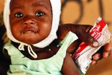 Malnourished 7-month-old Saamatou Bangou eats ready-to-use therapeutic food, in the health centre in Secteur (Sector) 7, a division of Fada N’gourma, the capital of Est Region, Burkina Faso. March 2012. ©UNICEF/Olivier Asselin 