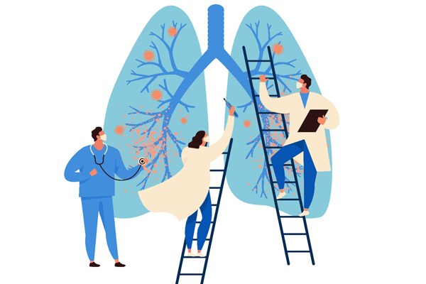 Illustration of three human figures working on infected lungs. 