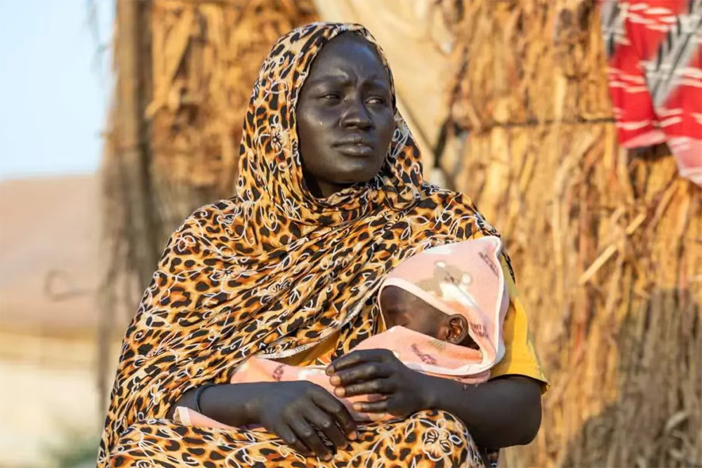 A displaced mother holding her baby who is suffering severe acute malnutrition