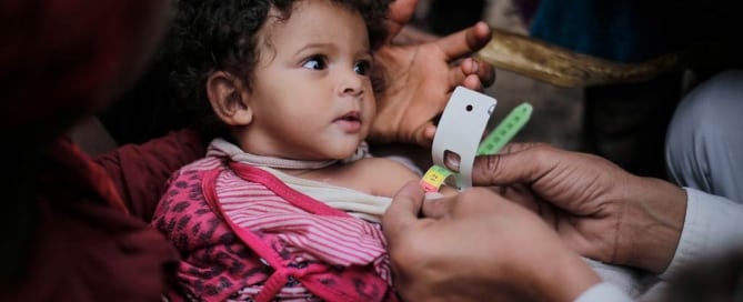 Una nña desnutrida es atendida por un médico en Yemen. Foto: UNICEF/Almang