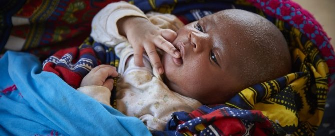 Bebé de nueve días acunado por su madre en Sierra Leona. Foto:UNICEF/Phelps